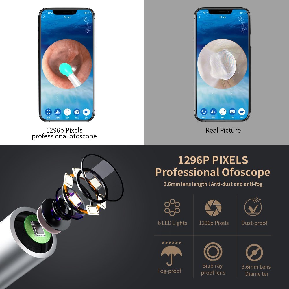 طقم تنظيف الأذن الذكي اللاسلكي مزود بكاميرا وضوء - الصورة 5